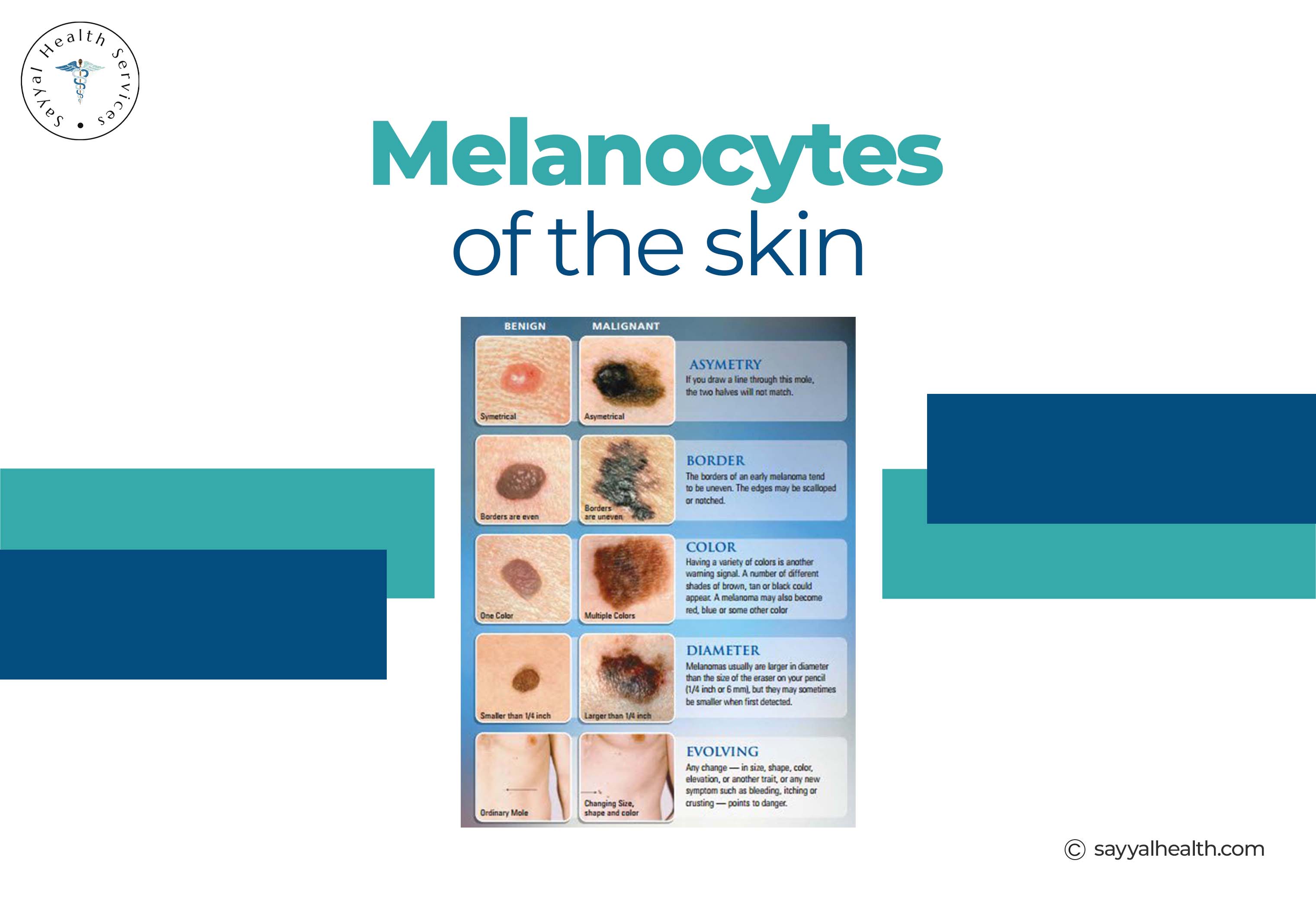 Melanoma of the Skin 